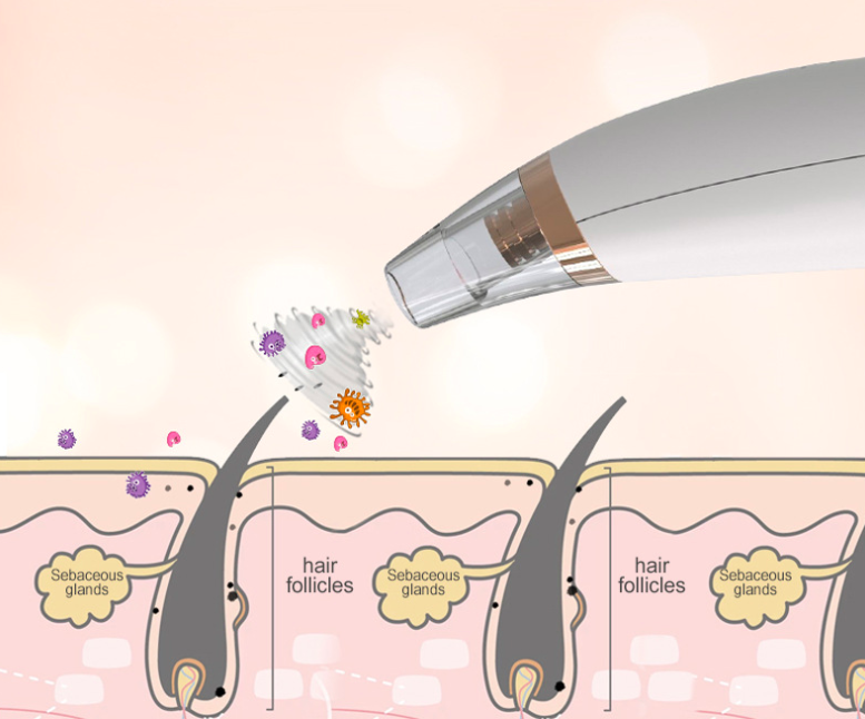 Removedor Eléctrico de Puntos Negros | Limpieza Facial Profunda en Casa